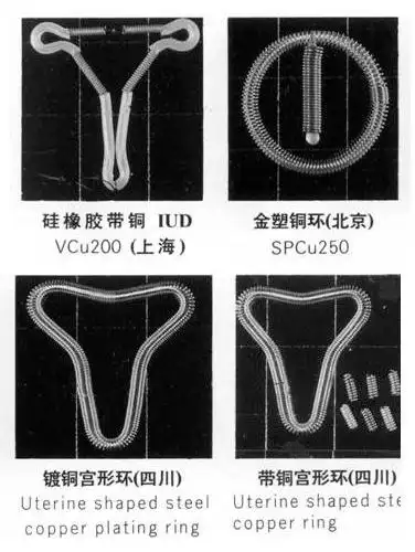 揭秘女性上环全过程组图