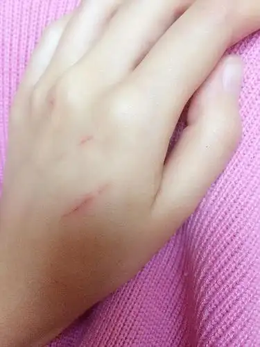 抓人,怎么给它剪指甲.