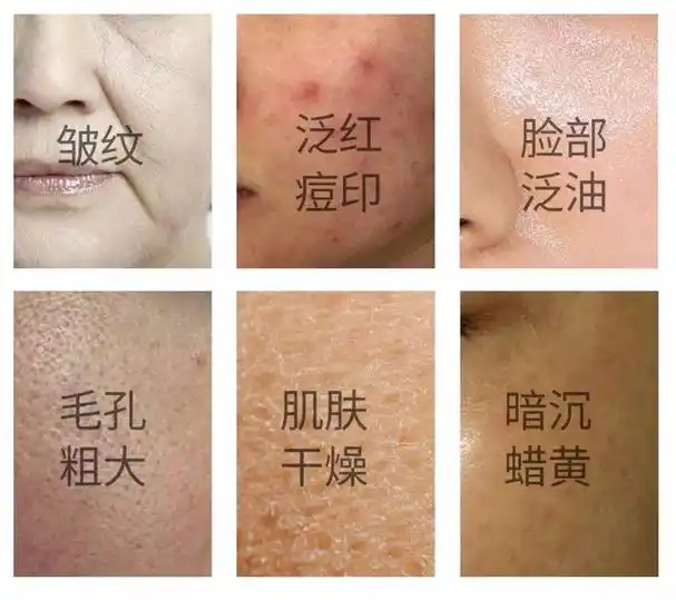 于是为了解决自己面部的皮肤问题,很多女生模仿明星购买昂贵的奢侈