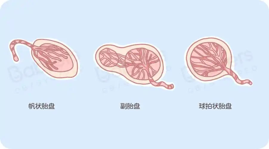 杭州美华提醒:胎盘很重要!但最后得当「垃圾」丢了