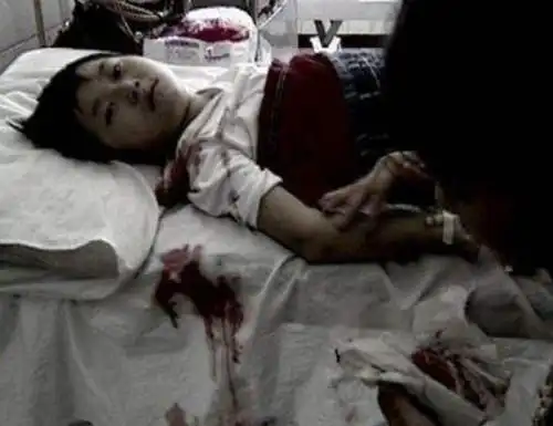 小苏丽事件是真的吗小苏丽验尸照片死后遭亲生母亲扒坟