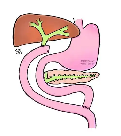 消化系统结构简图,消化系统手绘简易图