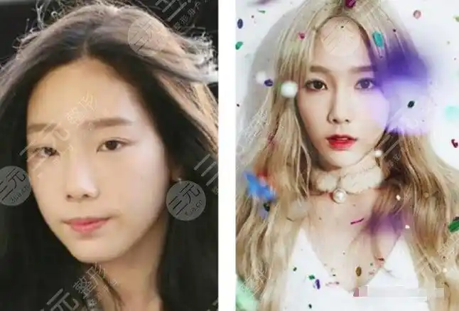 而从很多韩国明星的眼睛来说,韩国人不喜欢太过明x的双眼皮,整体是