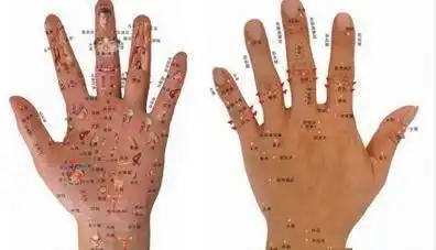手上长痣代表什么手心手背长痣