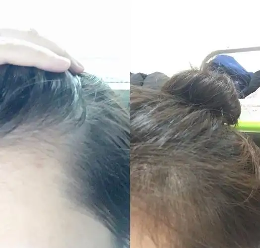 生发我最有经验啦