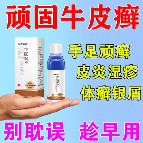 牛皮癣专用的药顽固牛皮癣银屑y病顽癣净牛皮癣软膏外用股癣膏大 单盒