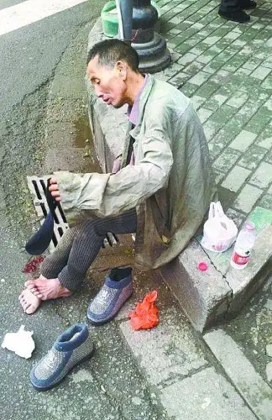残疾男赤脚流浪武汉街头好心女买鞋袜求其穿上