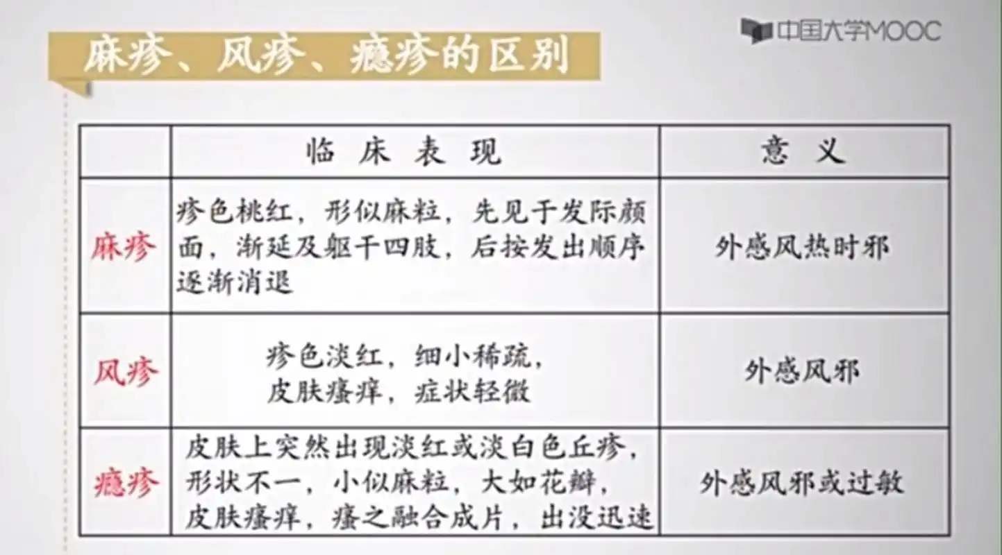 中医"麻疹""风疹""瘾疹"一一区别,临床表现和意义