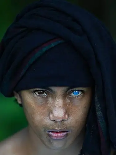 他们是亚洲人却被称蓝精灵天生拥有蓝眼睛背后故事让人无奈