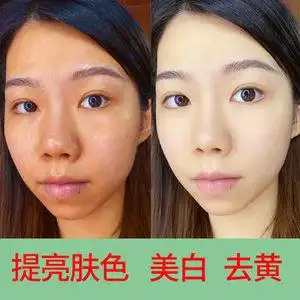 去黄气提亮肤色美白脸色暗黄改善暗沉肤色护肤品去黑色素脸部精华