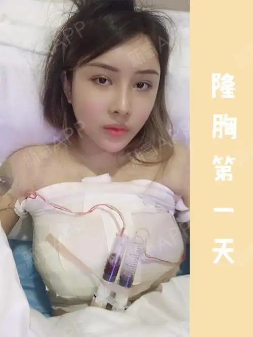 从b到d,胸大是一种什么样的体验?#合肥探店#.本_圈子-新氧美容整形