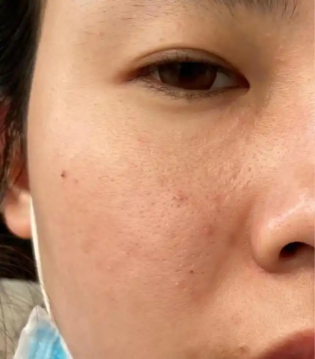 脸部需不需要补水?留意一下这几个脸部特征,可以预防脸部缺水!