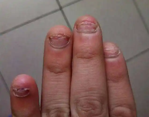 如果家长勤于和孩子进行亲子互动行为的话,那么,孩子就会失去咬手指甲