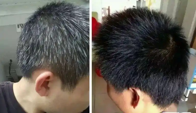 有白发不要着急染,洗发水换成它,白发悄悄黑回来,还能防掉发!