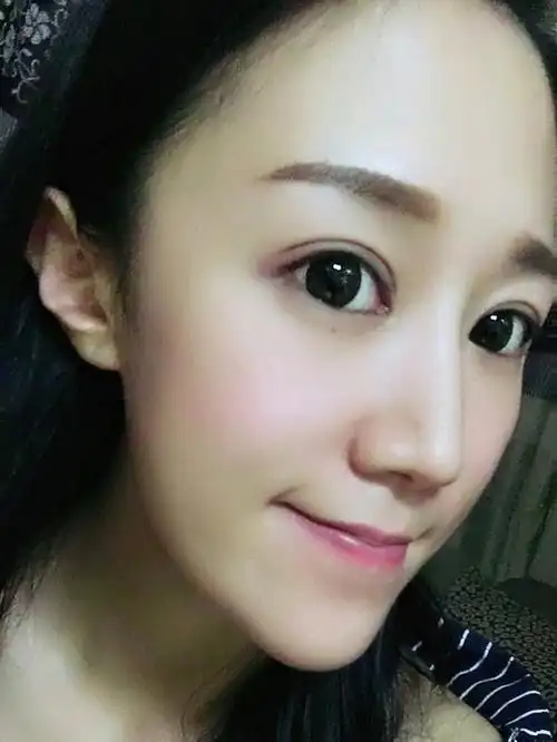 小平扇的双眼皮形态是终于出来了