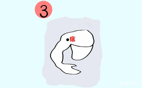 男人4颗黄金吉痣,横财缠身,发大财,行大运,升官发财快