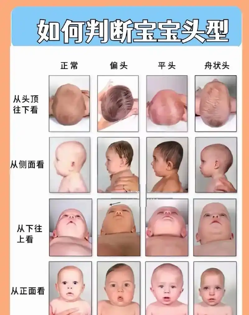 创作灵感 宝宝头型怎么睡好看?#人类幼崽成长记 #新生儿  - 抖音