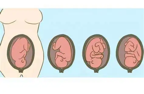 枕横位是什么意思 胎位右枕横位是什么意思 -育儿知识