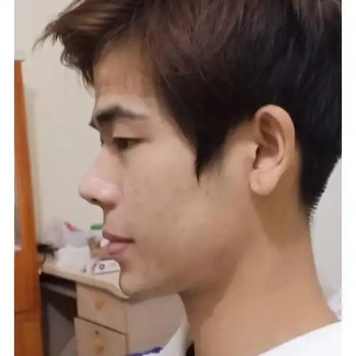 嘴唇有一点凸,还有口角囊袋,下巴有点短,但是人无完人,你的侧脸已经很