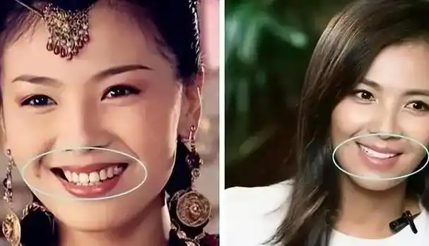 明星"烤瓷牙"有多可怕?有的亮得发蓝,有的嘴包不住牙,辣眼睛