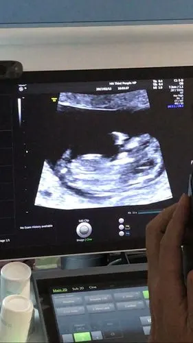 贫穷!nt三个亮点是男孩女孩"藕断丝连"-第2张图片-飘零博客