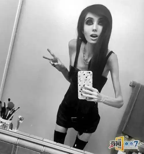 网红妹子瘦到30斤 出镜似僵尸