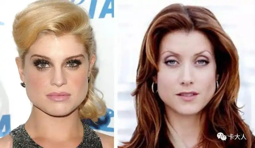 外扩 下颌角外扩但不超过颧弓=大方脸 下颌角外扩程度超过颧弓=梨形脸