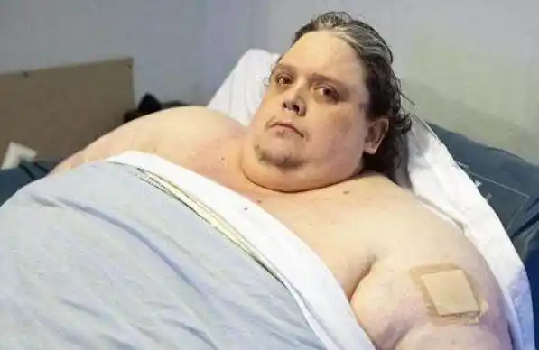 世界上最重的人 最重时体重高达889斤