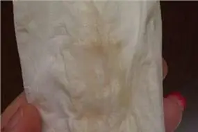 白带褐色带血丝图片