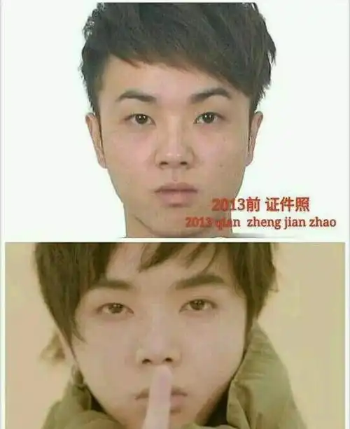 华晨宇一年一个样整容上瘾了