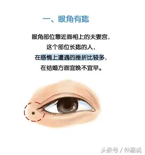 好痣妨好吗说a面相三种痣去掉命运女人,右眼角有痣的男人代表什么意思