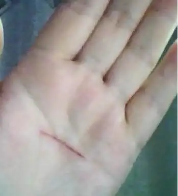 谁有刀伤图片,刀疤的也可以