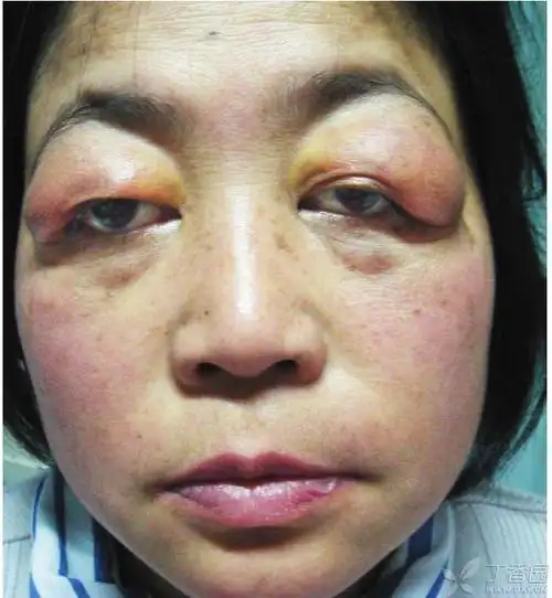 可能涉及到敏感图片,点击后可查看