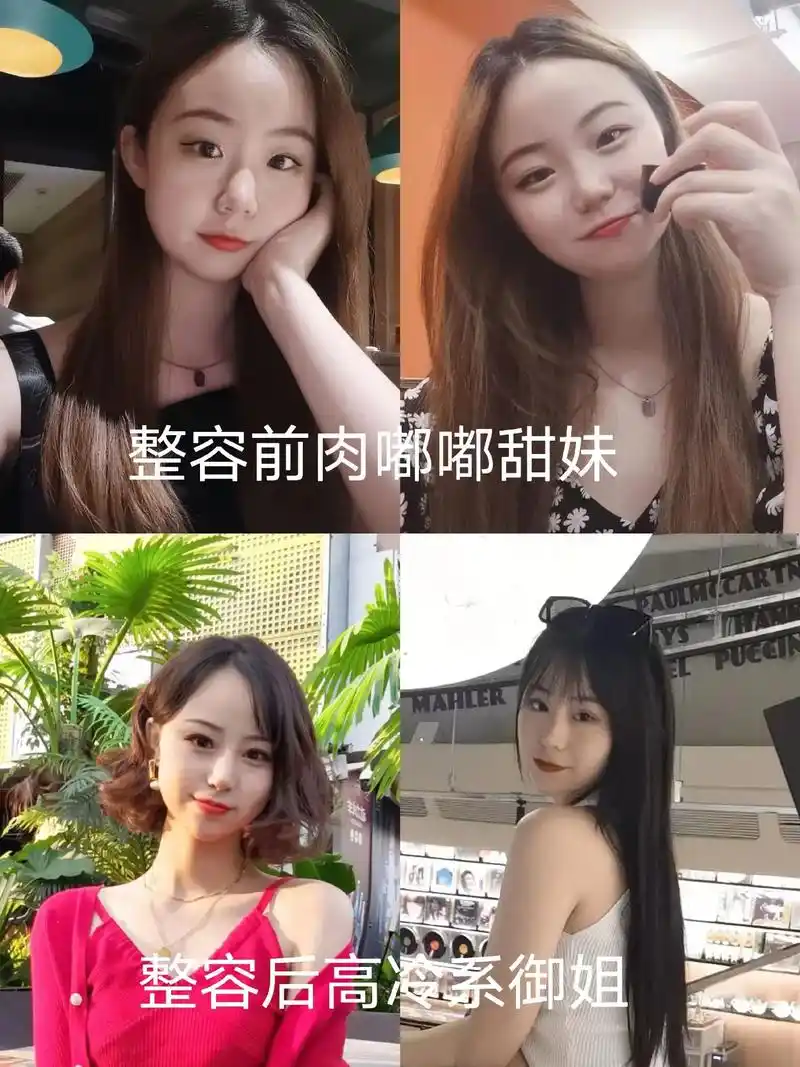 整容小一年的变化(后天第一眼美女)主要微调了:1隔双眼皮2做 - 抖音