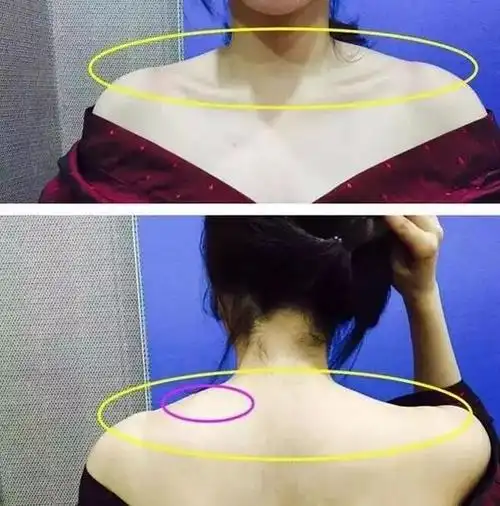 我被斜方肌吓到了…先瘦这个部位让你显瘦20斤!