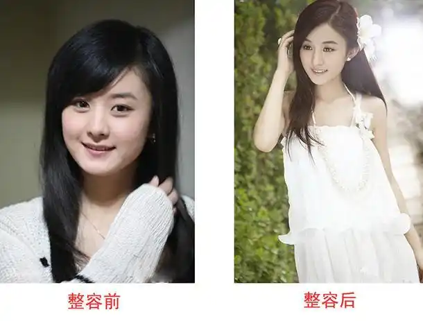 赵丽颖脸怎么变小的 赵丽颖整容前照片曝