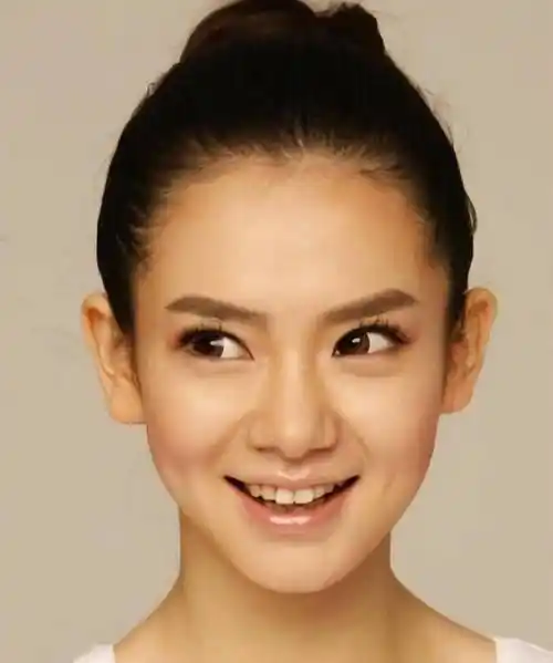 双眼皮手术再常见也别乱割!