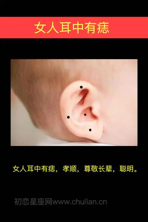 女人耳中有痣