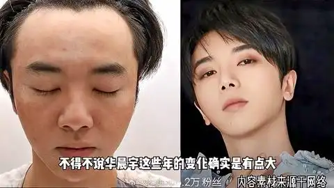 华晨宇被爆整容植发,前女友发视频称张碧晨是小三,本人暂未回应