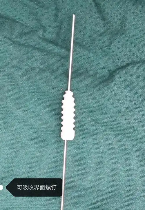 精湛技艺——关节镜微创治疗 - 美篇