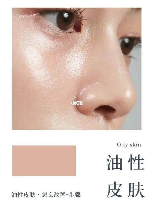 油性皮肤怎么改善做好这7个护理步骤