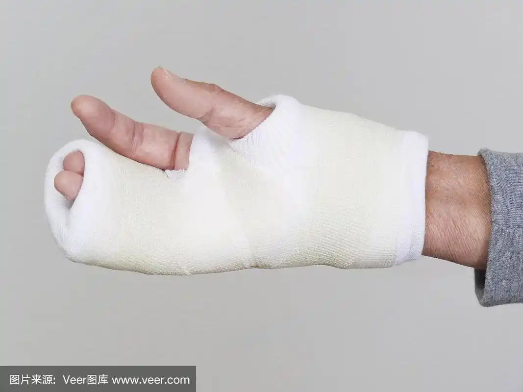 右手铸型,掌心朝上