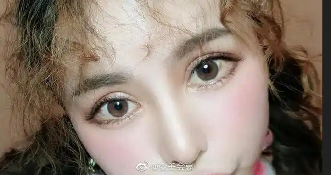 成都双眼皮修复##芭比眼