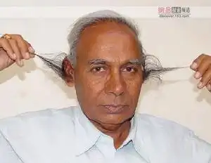 人类外耳道多毛症