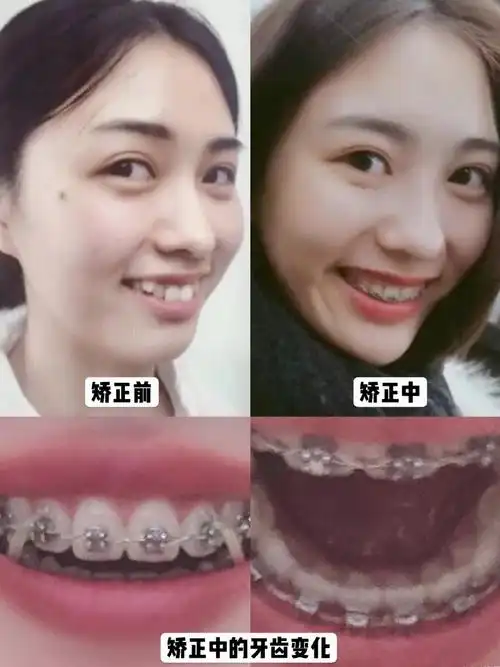 虎牙破坏气质小姐姐矫正变身成熟女神