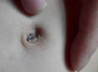 抠肚脐会肚子疼?里面的泥是什么?肚脐突出或者凹陷有影响吗?