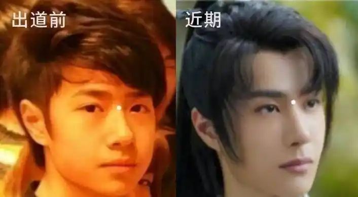 8位改头换命的男明星王一博脸已僵硬刘恺威眼皮才是灵魂