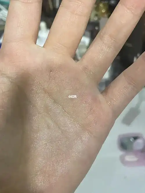 左手中指下长了一颗痣诶