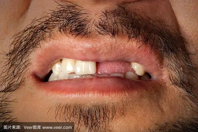 没有牙齿的人近距离拍摄