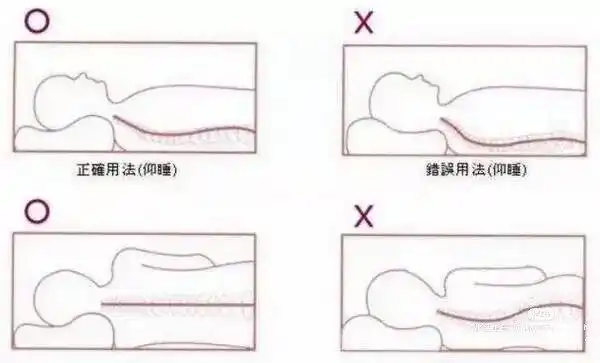姐妹们,你们知道正确的枕枕头的方式吗?